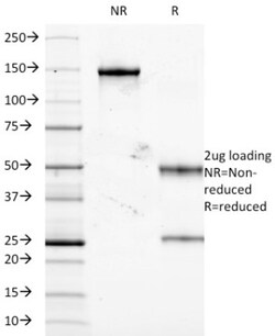 TNF-alpha Antibody (J2D10), Novus Biologicals 0.2mg; Unlabeled:Antibodies,